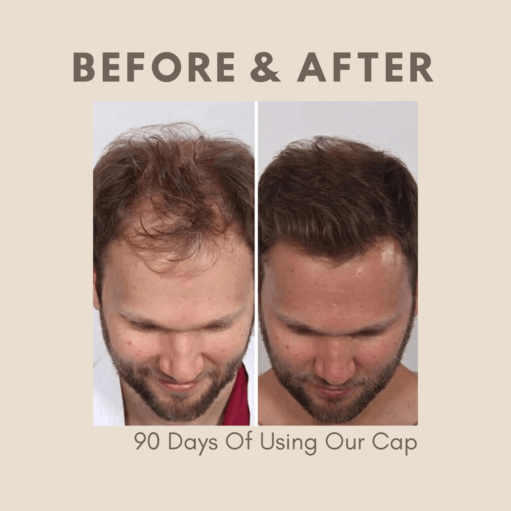 Red Light Therapy Cap